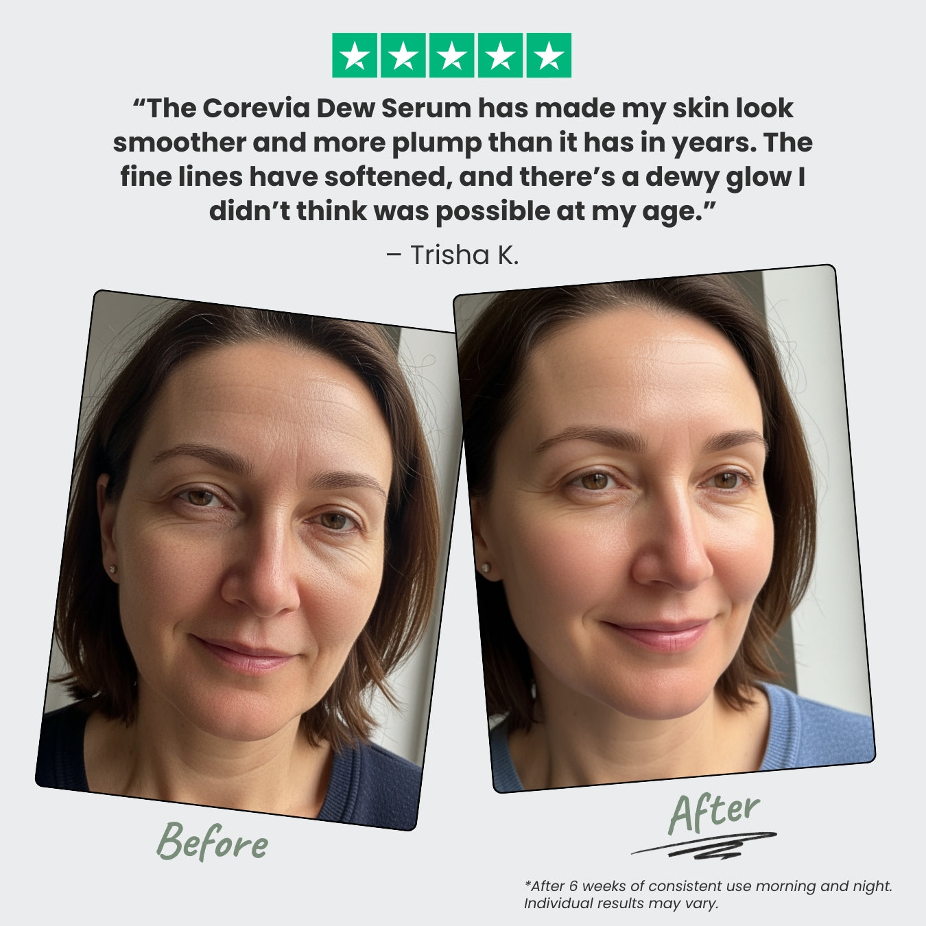 Dew Serum | Multi-Weight Hyaluronic Acid Face Serum for Hydration & Plump Skin | 1 fl oz | Cruelty-Free, Made in USA